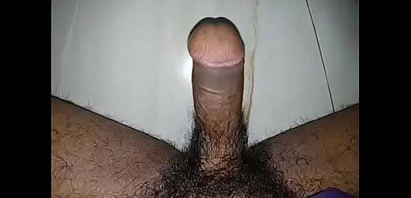  bangladesi hypospadias penis